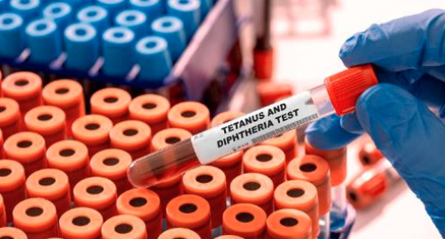 Plateau Records 23 Diphtheria Deaths, 143 Suspected Cases In Two Weeks